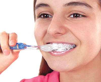 Can I Brush My Invisalign With Toothpaste?: Best Practices